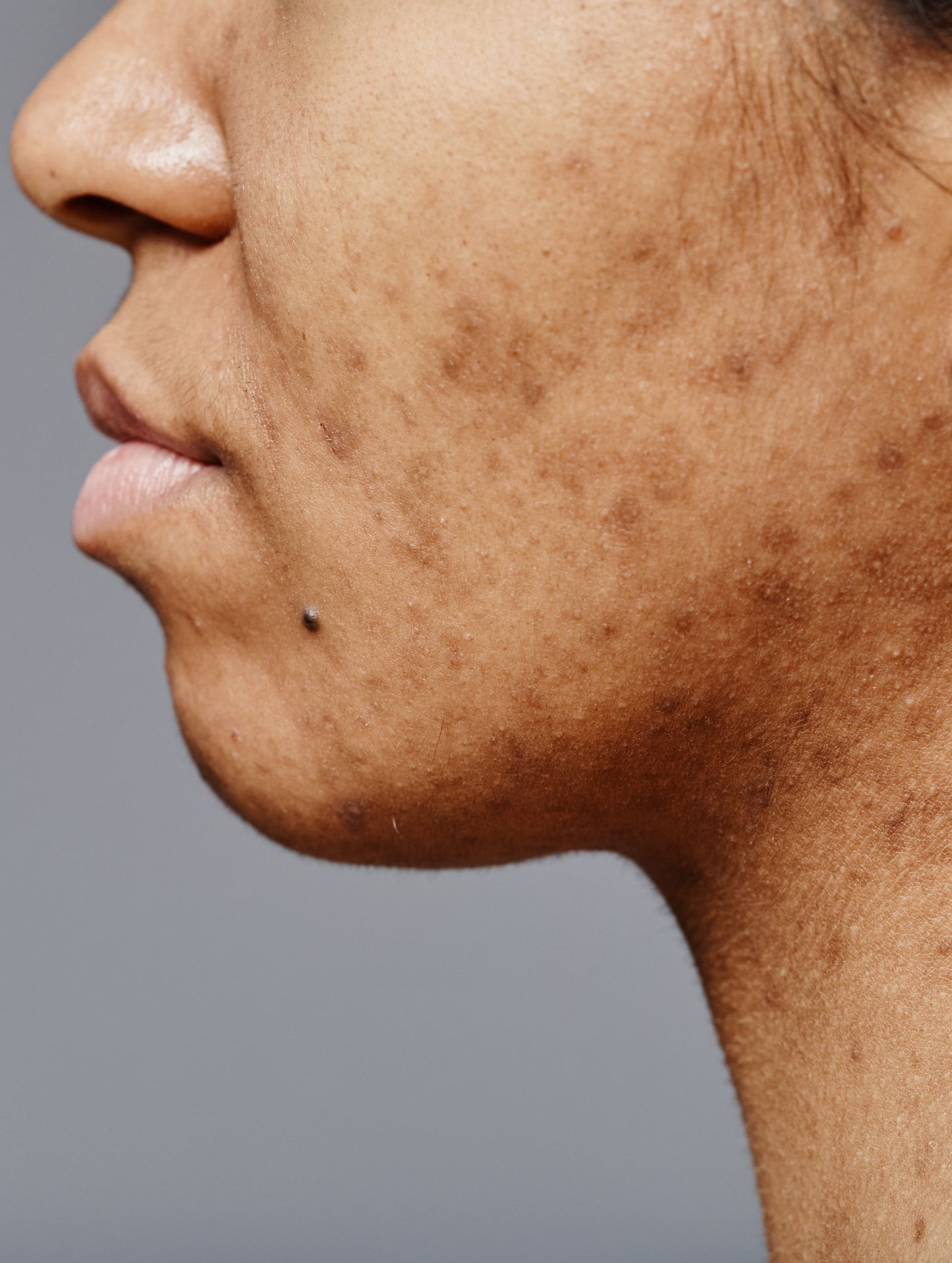 ECLAT – Sérum Anti-Taches Brunes & Unifiant au Complexe Botanique | 30 ml